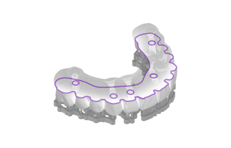 NanoCure surgical guide design outline view